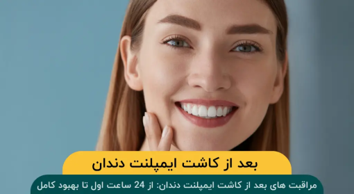 مراقبت-های-بعد-از-کاشت-ایمپلنت-دندان